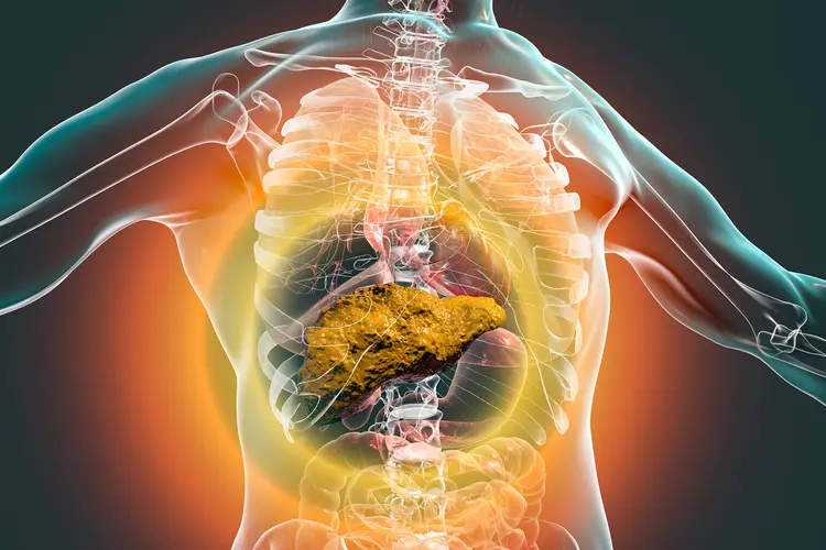 Liver Cirrhosis Symptoms – Late Stage Warning Signs Explained