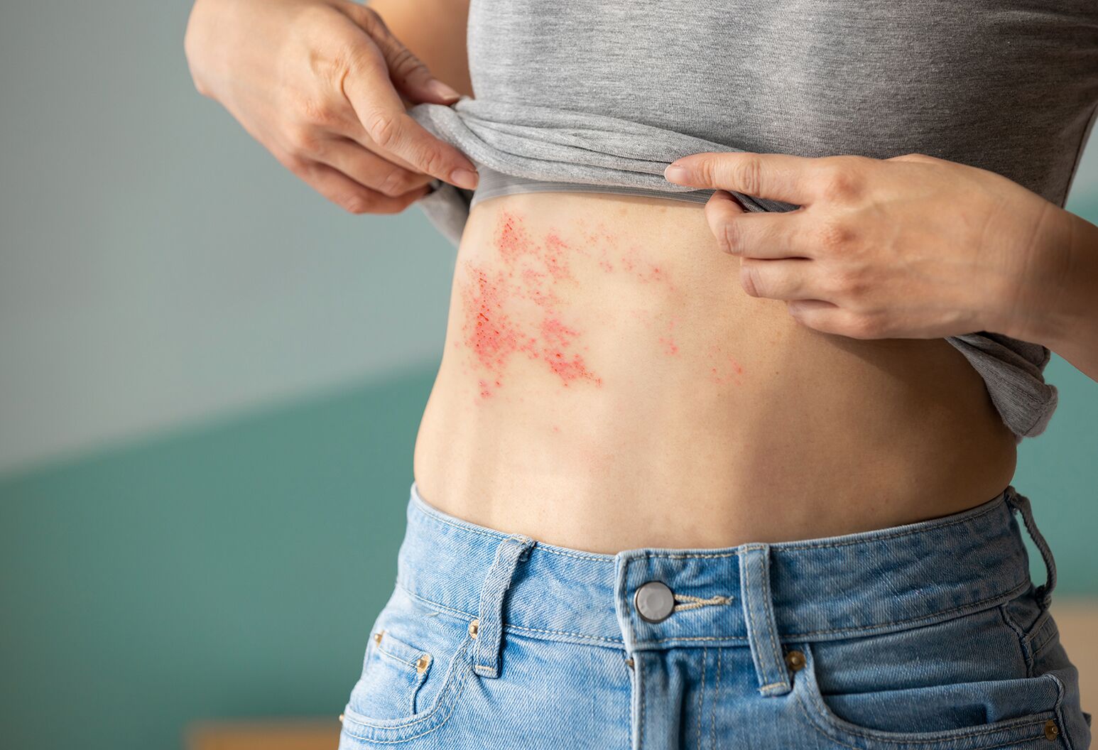 HIV Symptoms: Early-Stage Signs Explained Clearly